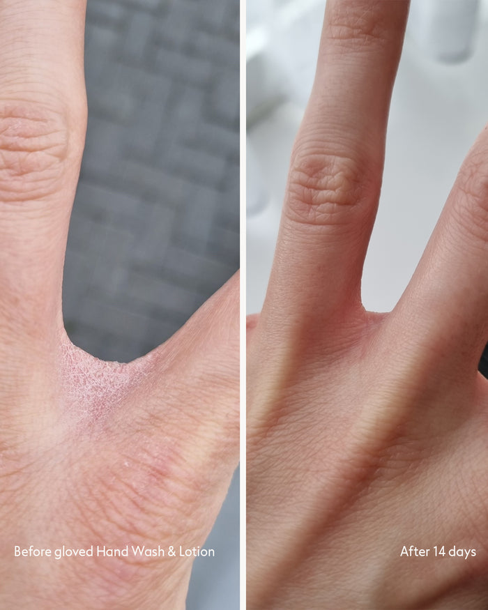 Customer before & after