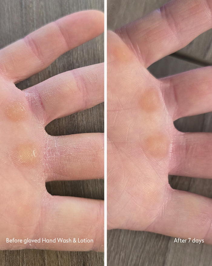 Customer before & after