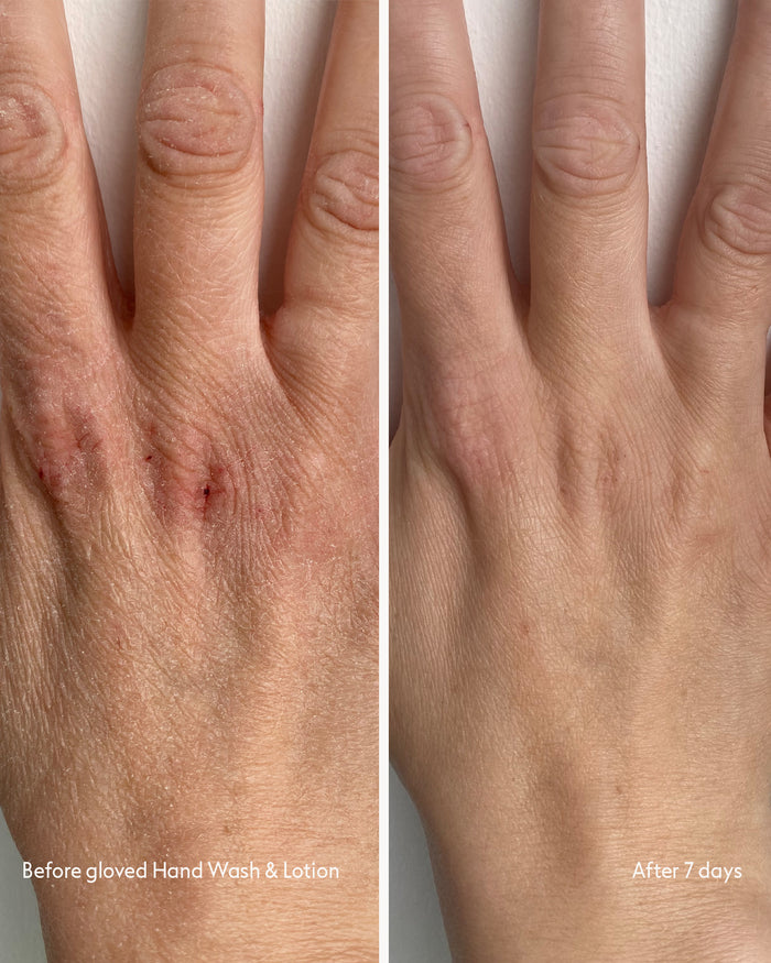 Customer before & after